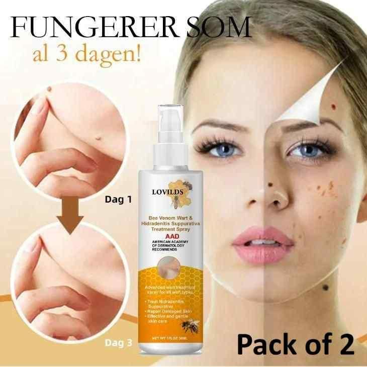 Bee Venom Wart Remover Spray 30ml (Pack of 2)