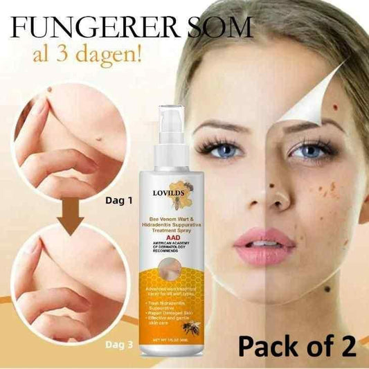 Bee Venom Wart Remover Spray 30ml (Pack of 2)