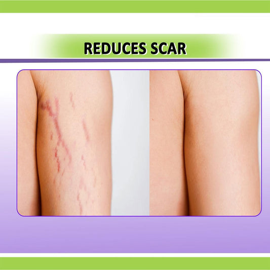 Panchvati Herbal Body Gel for Stretch Marks 100gm