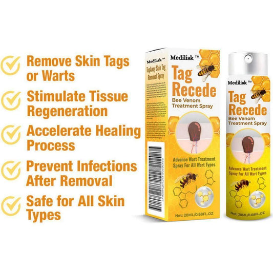 Bee Venom Wart Remover Spray 30ml (Pack of 2)