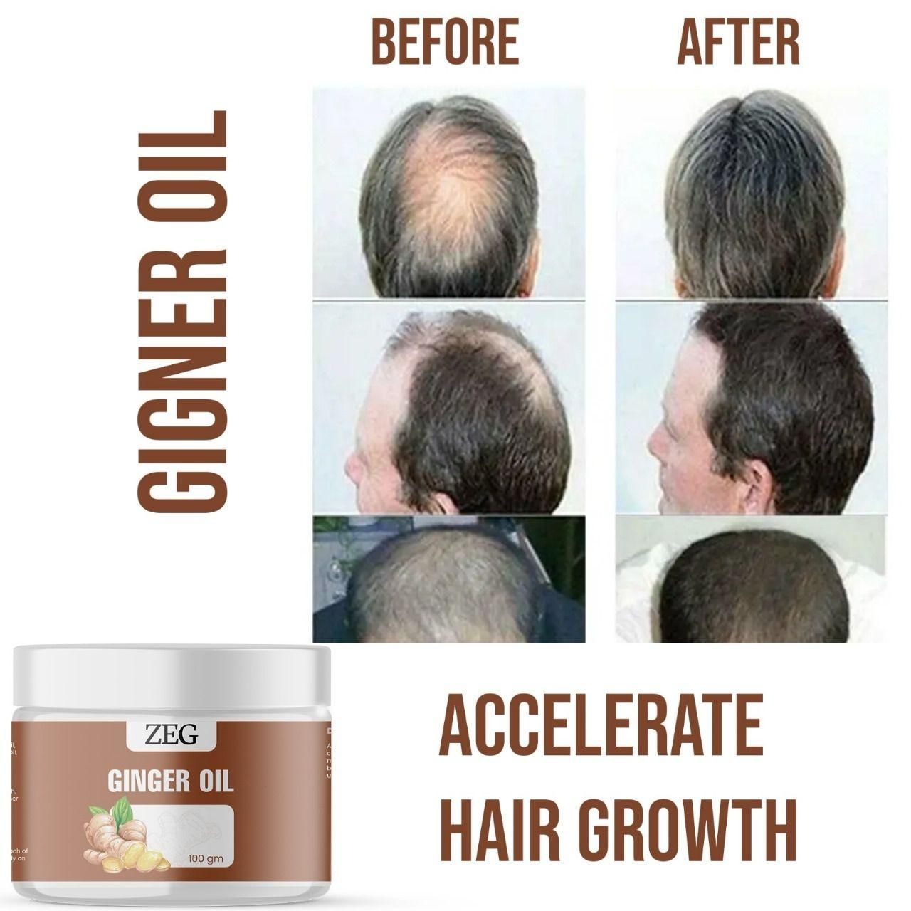 ZEG GINGER OIL 100GM ? 100% Natural Multipurpose Oil for Hair, Skin & Body